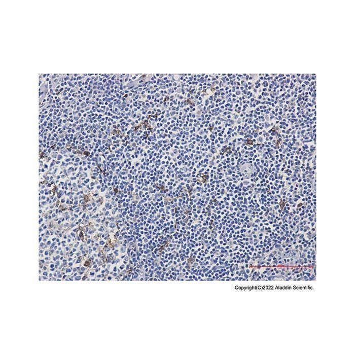 Recombinant MERTK Antibody -    by Aladdin Scientific