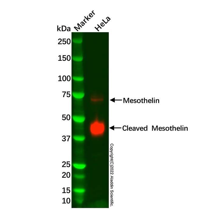 Recombinant Mesothelin Antibody -    by Aladdin Scientific