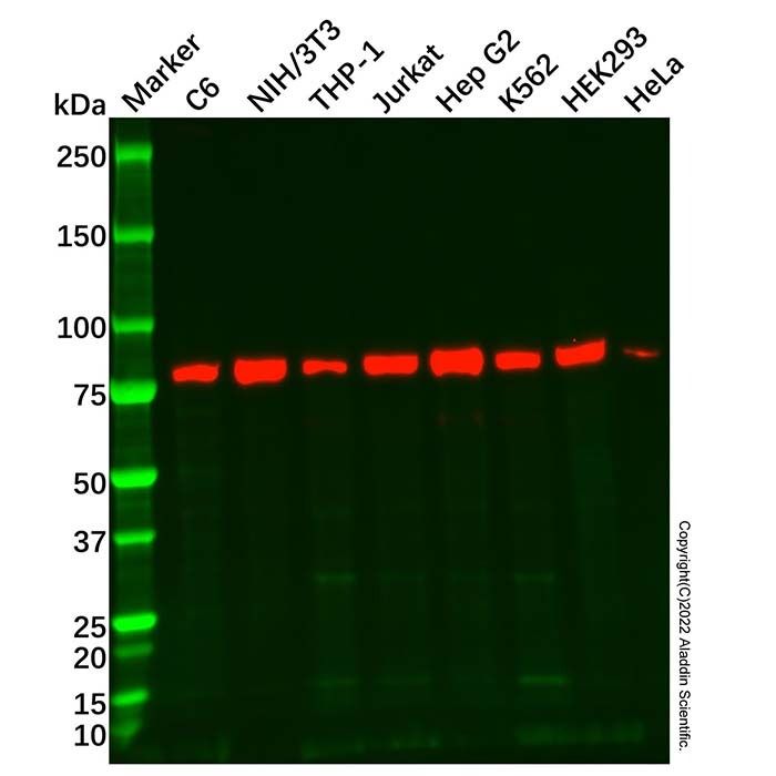 Recombinant Methylmalonyl Coenzyme A mutase Antibody -    by Aladdin Scientific