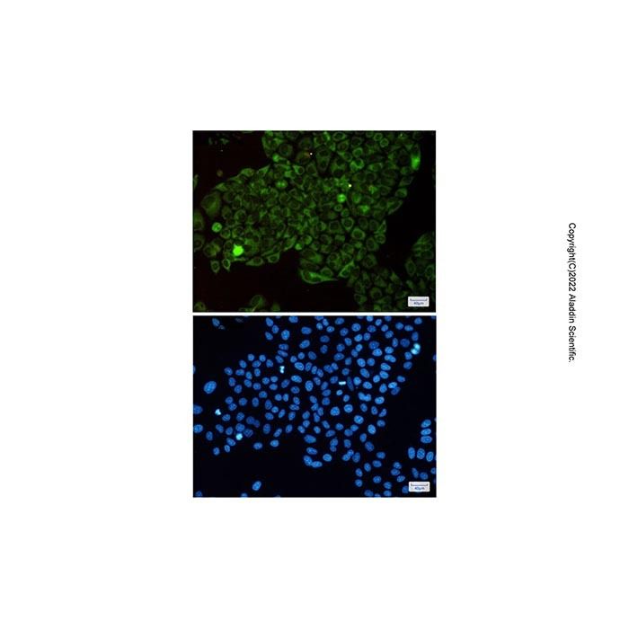 Recombinant MetRS/MARS Antibody -    by Aladdin Scientific