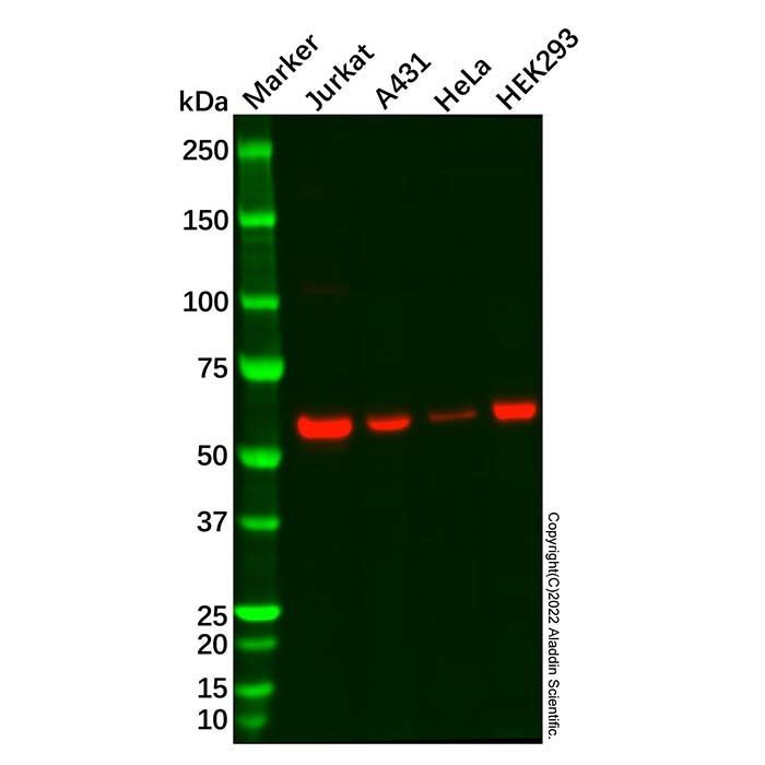 METTL14 Antibody -    by Aladdin Scientific