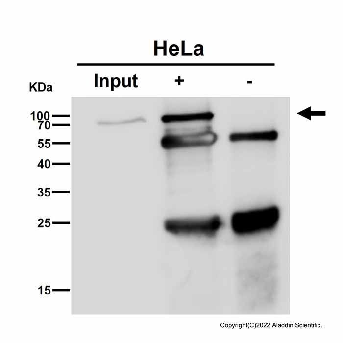 Recombinant METTL3 Antibody -    by Aladdin Scientific