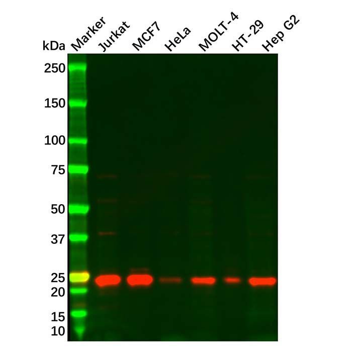 MGMT Antibody -    by Aladdin Scientific