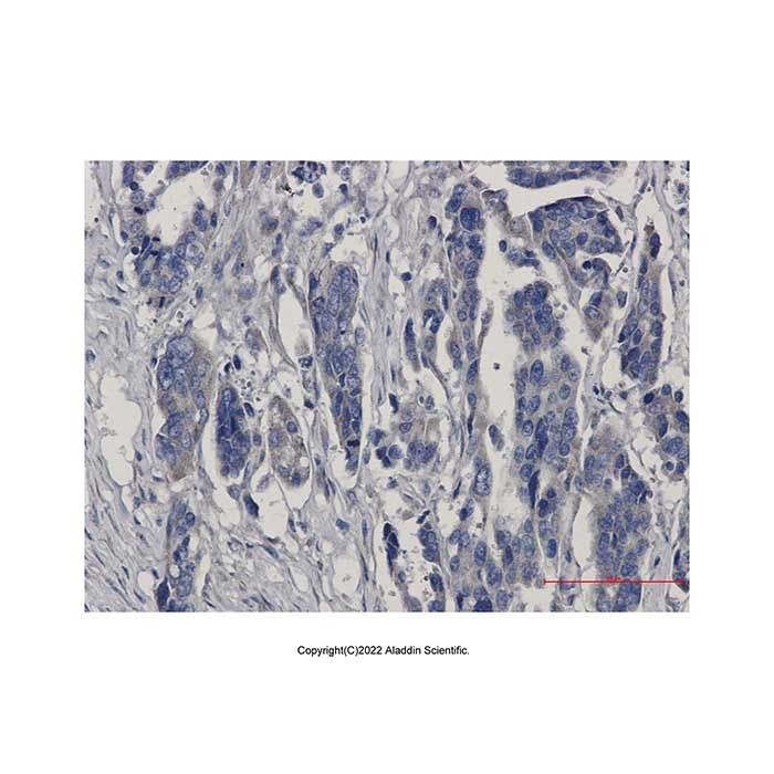 Recombinant MGST1 Antibody -    by Aladdin Scientific