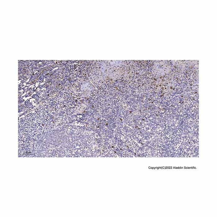 MICB Antibody -    by Aladdin Scientific