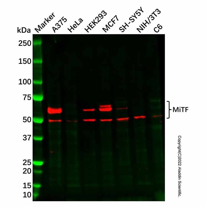 Recombinant MiTF Antibody -    by Aladdin Scientific