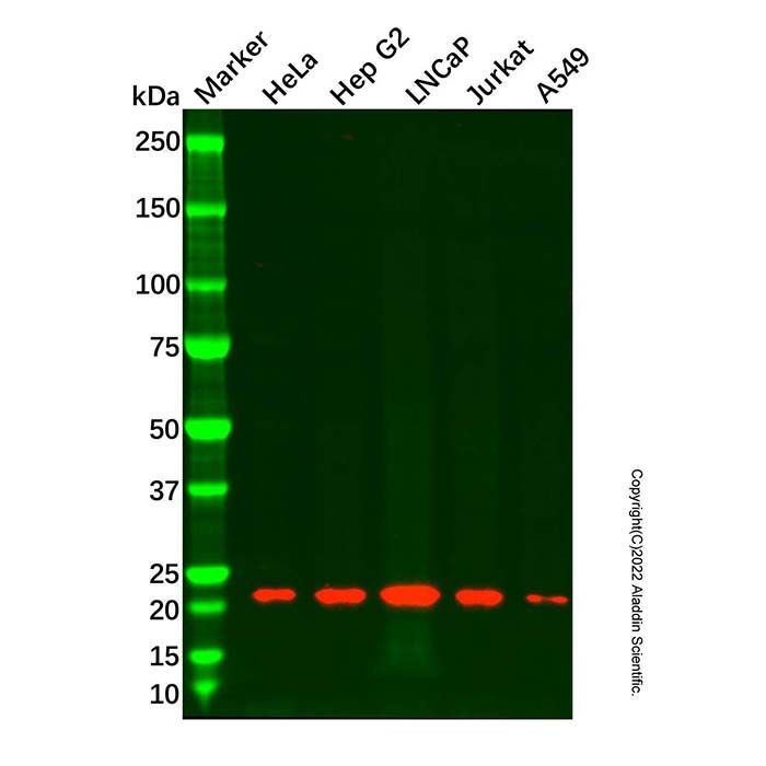 Recombinant Mitochondrial ribosomal protein L11 Antibody -    by Aladdin Scientific
