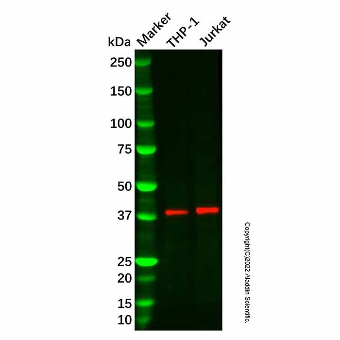 Recombinant MK-3 Antibody -    by Aladdin Scientific