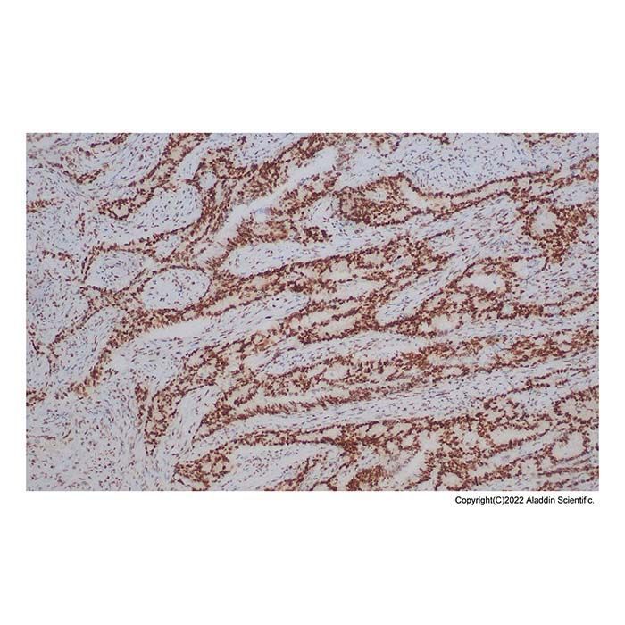 Recombinant MLH1 Antibody -    by Aladdin Scientific