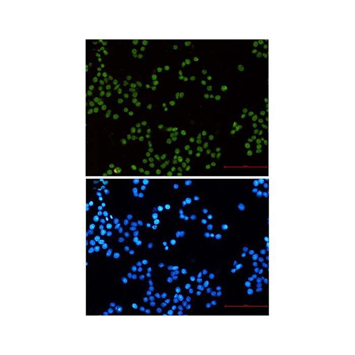 Recombinant MLH1 Antibody -    by Aladdin Scientific
