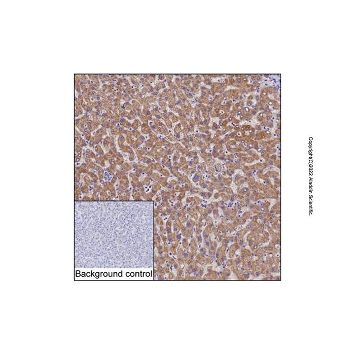 MMAB Mouse mAb -    by Aladdin Scientific