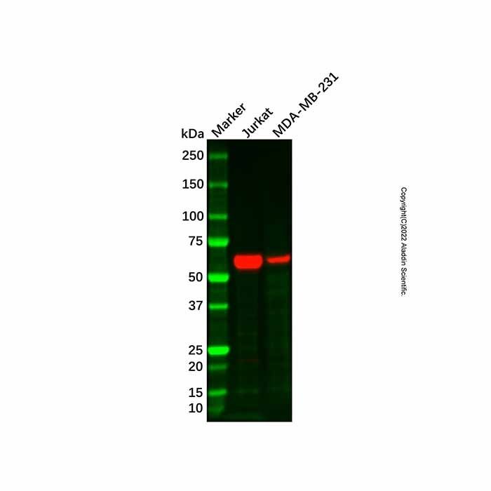 Recombinant MMP13 Antibody -    by Aladdin Scientific