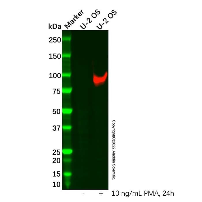 MMP9 antibody -    by Aladdin Scientific
