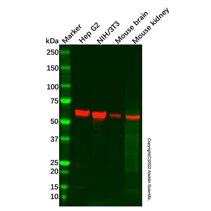 Recombinant Monoamine Oxidase A/MAO-A Antibody -    by Aladdin Scientific