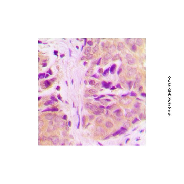 MRPL18 Antibody -    by Aladdin Scientific