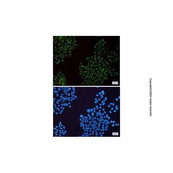 Recombinant MRPS26 Antibody -    by Aladdin Scientific