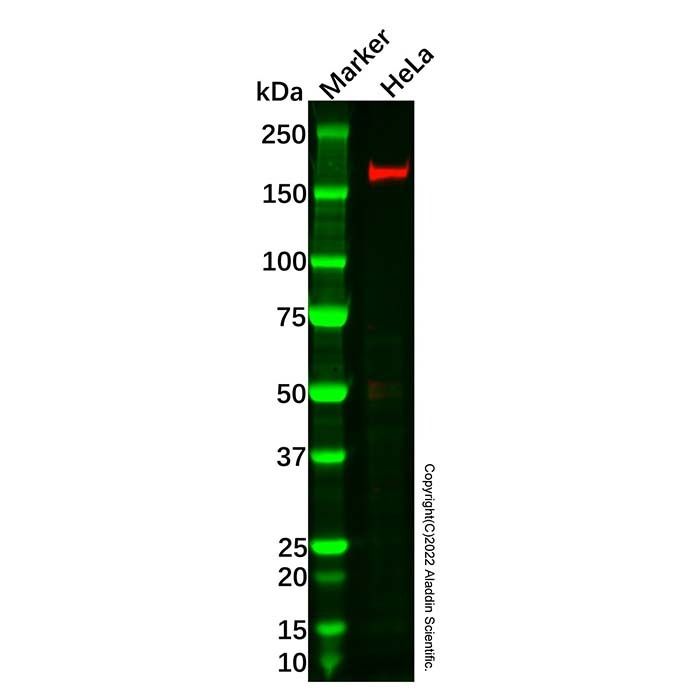 Recombinant MSH6 Antibody -    by Aladdin Scientific