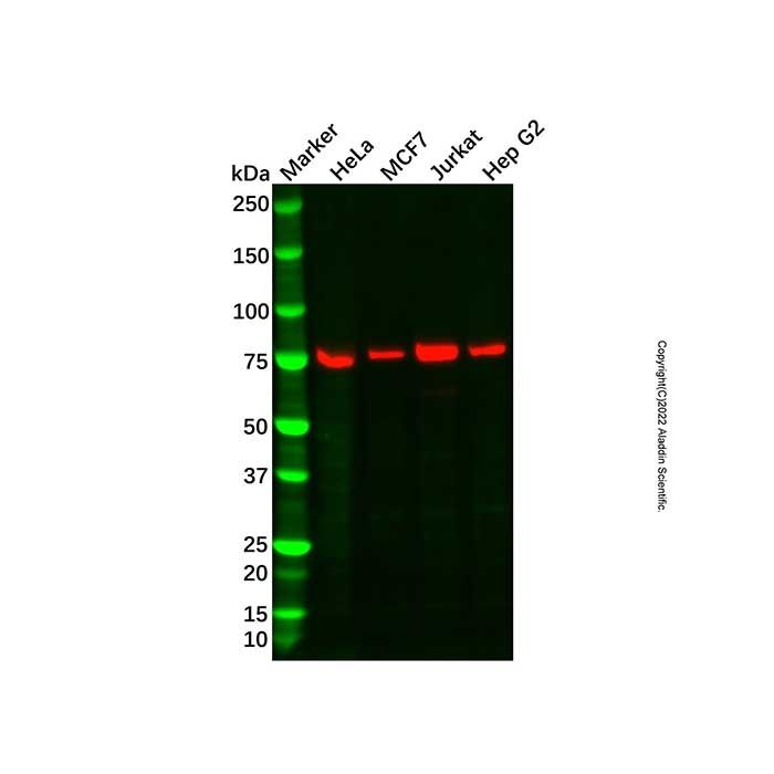 Recombinant MTA2/PID Antibody -    by Aladdin Scientific