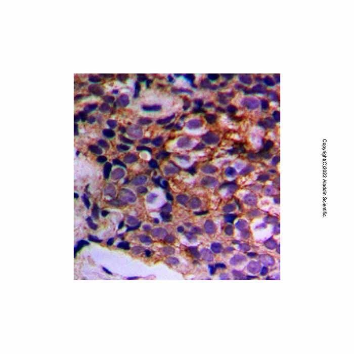 MTIF3 Antibody -    by Aladdin Scientific