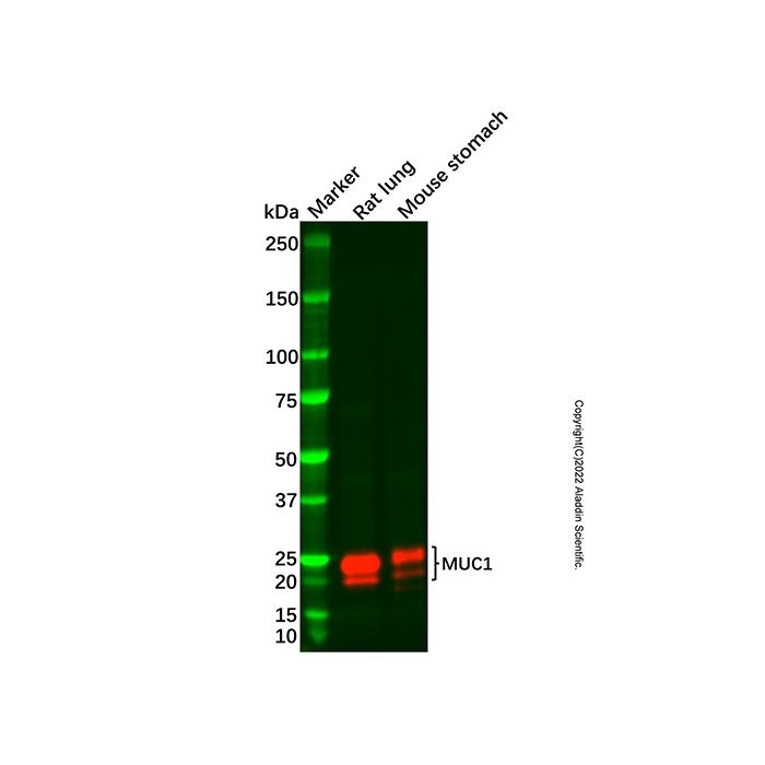 Recombinant MUC1 Antibody -    by Aladdin Scientific