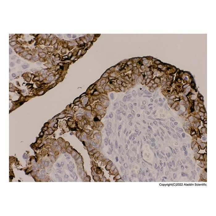 Recombinant MUC1 Antibody - by Aladdin Scientific