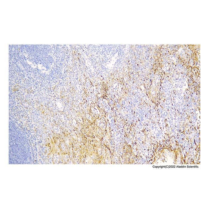 Recombinant MUC1 Antibody - by Aladdin Scientific