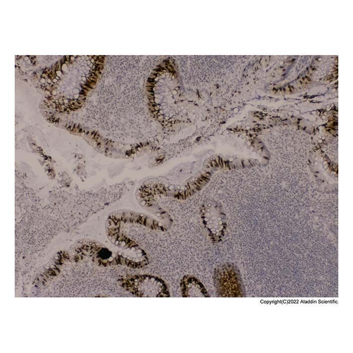 Recombinant MUC2 Antibody -    by Aladdin Scientific