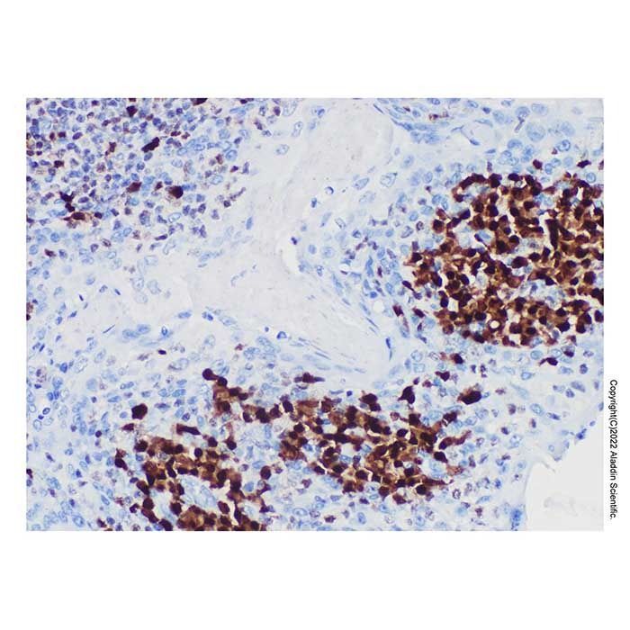 IRF4 Mouse mAb -    by Aladdin Scientific