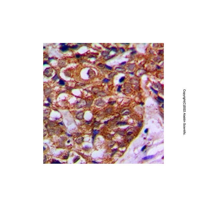 MVK Antibody -    by Aladdin Scientific
