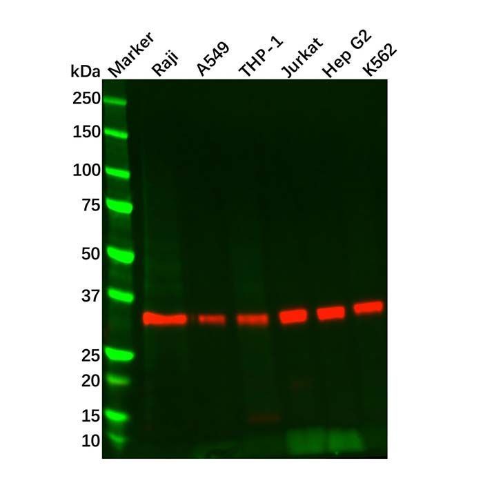 Recombinant MyD88 Antibody -    by Aladdin Scientific