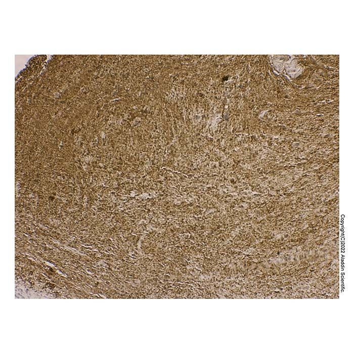 Recombinant Myelin Basic Protein Antibody -    by Aladdin Scientific