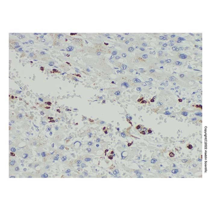 Myeloperoxidase Mouse mAb -    by Aladdin Scientific