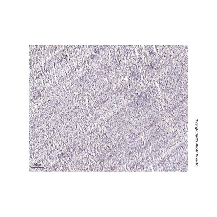 MYL5 Antibody -    by Aladdin Scientific