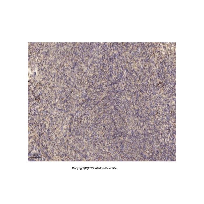 MYL7 Antibody -    by Aladdin Scientific