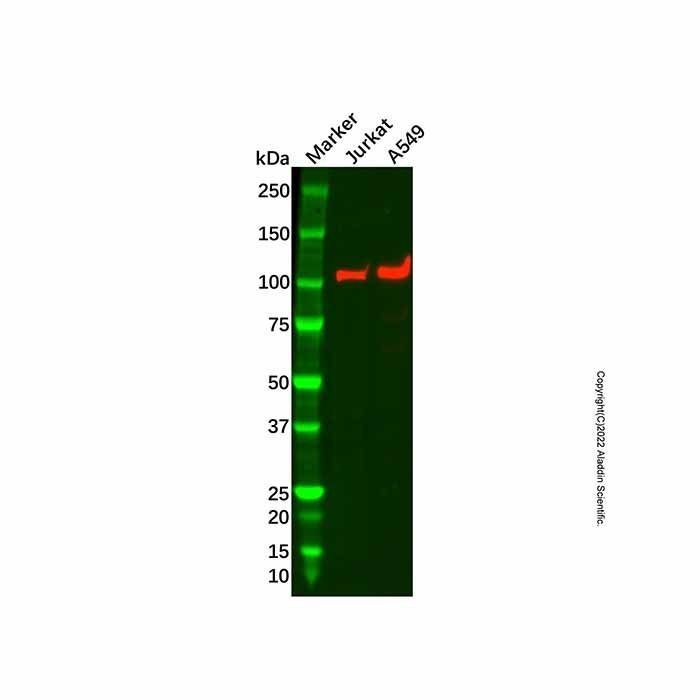 Recombinant MYO19 Antibody -    by Aladdin Scientific