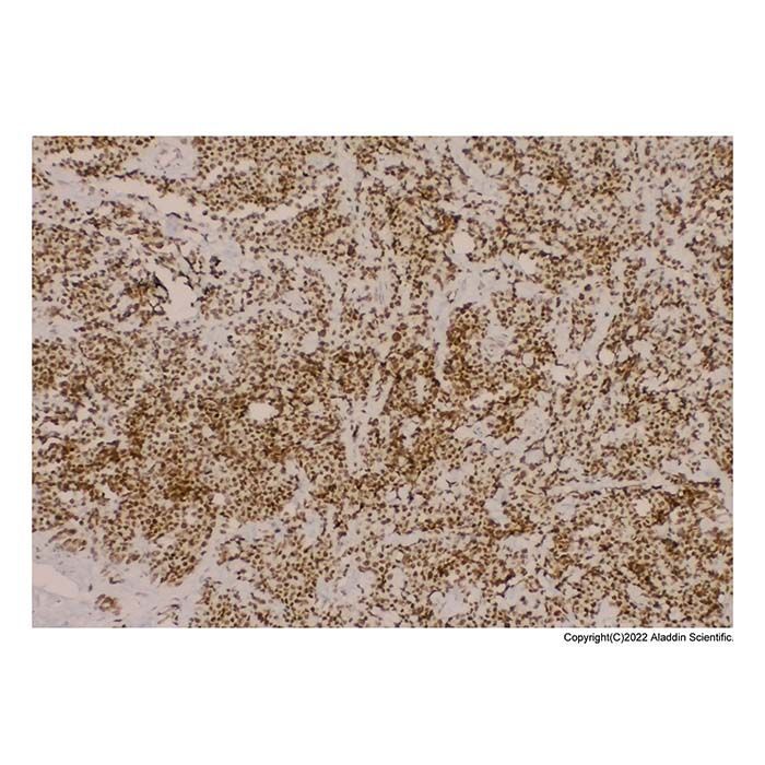 Recombinant MyoD1 Antibody -    by Aladdin Scientific