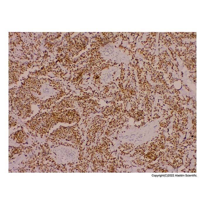 Recombinant Myogenin Antibody -    by Aladdin Scientific