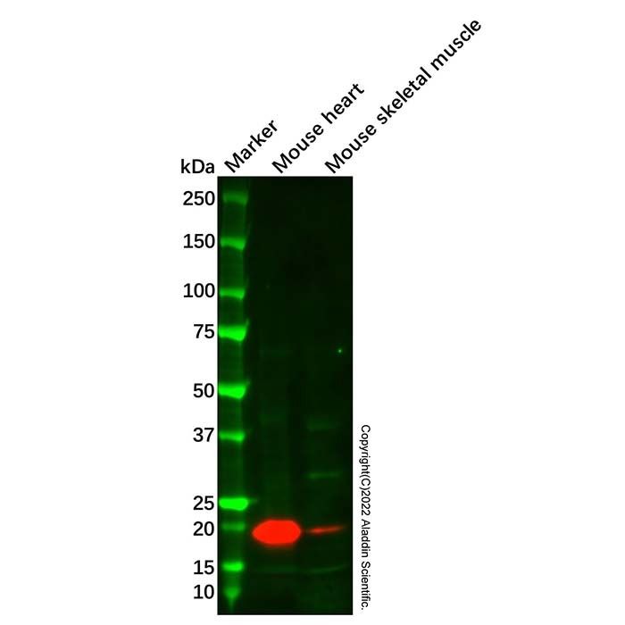 Recombinant Myosin Light Chain 2 Antibody -    by Aladdin Scientific
