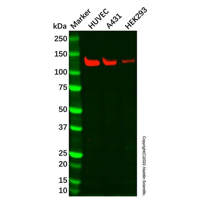 Recombinant Myosin light chain kinase/MLCK Antibody -    by Aladdin Scientific