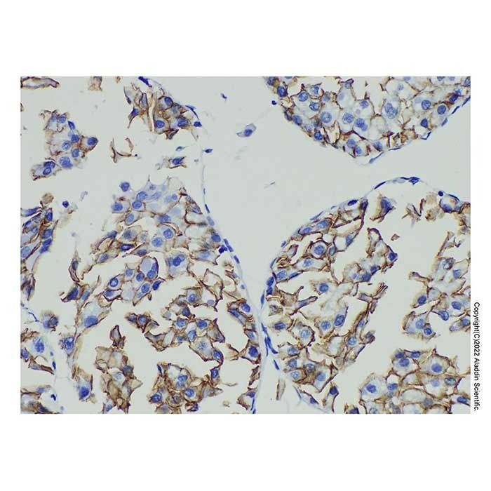 N Cadherin Mouse mAb -    by Aladdin Scientific