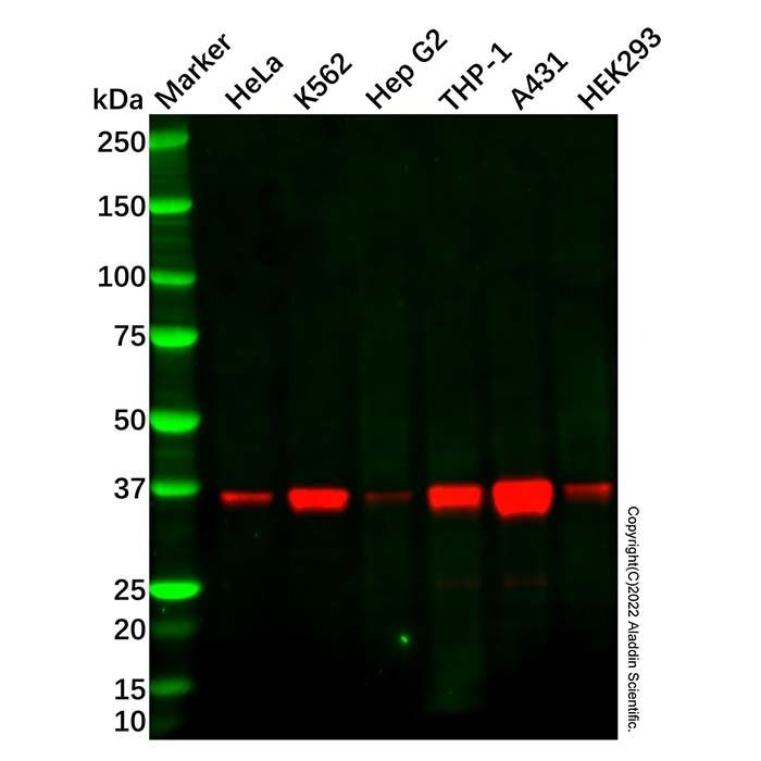 Recombinant N myc interactor/NMI Antibody -    by Aladdin Scientific