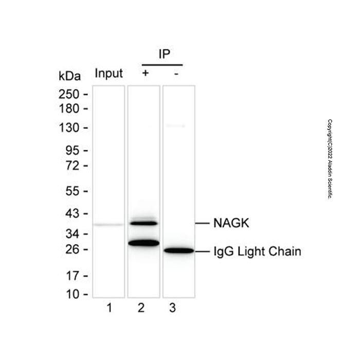 NAGK Mouse mAb -    by Aladdin Scientific
