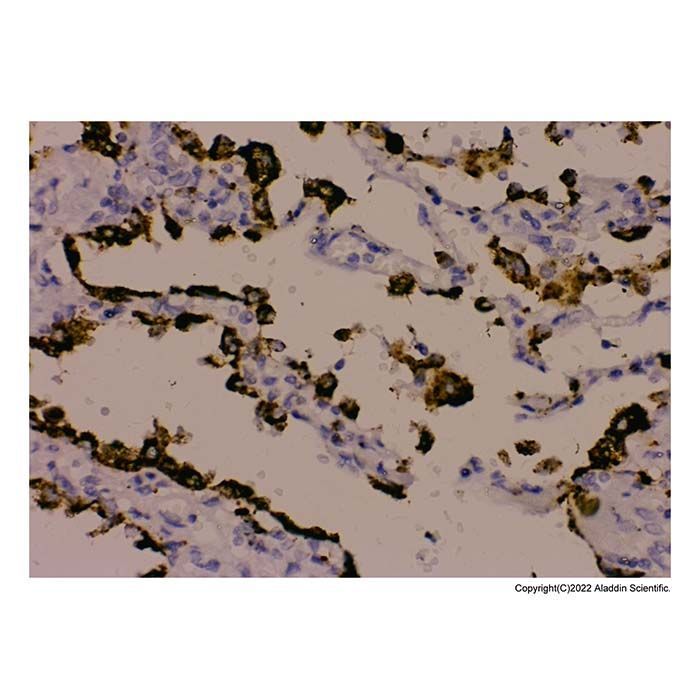 Recombinant NAPSIN A Antibody -    by Aladdin Scientific
