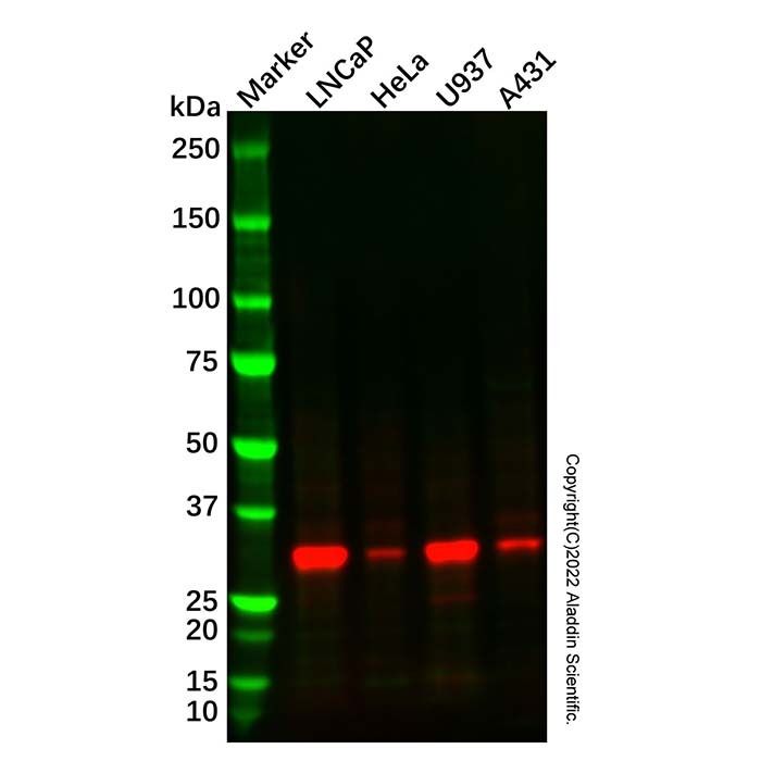 Recombinant NAT1 Antibody -    by Aladdin Scientific