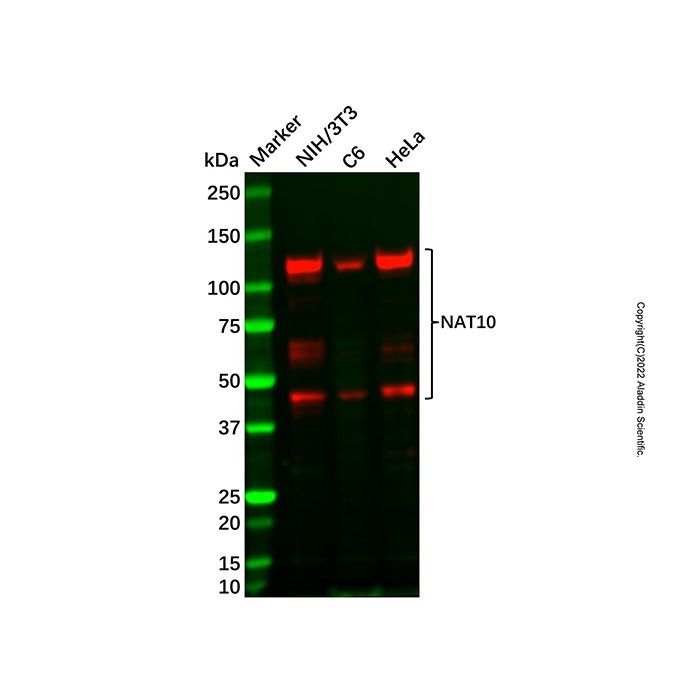 Recombinant NAT10 Antibody -    by Aladdin Scientific