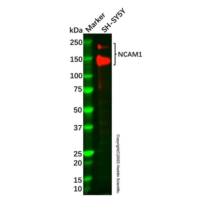 Recombinant NCAM1 Antibody -    by Aladdin Scientific