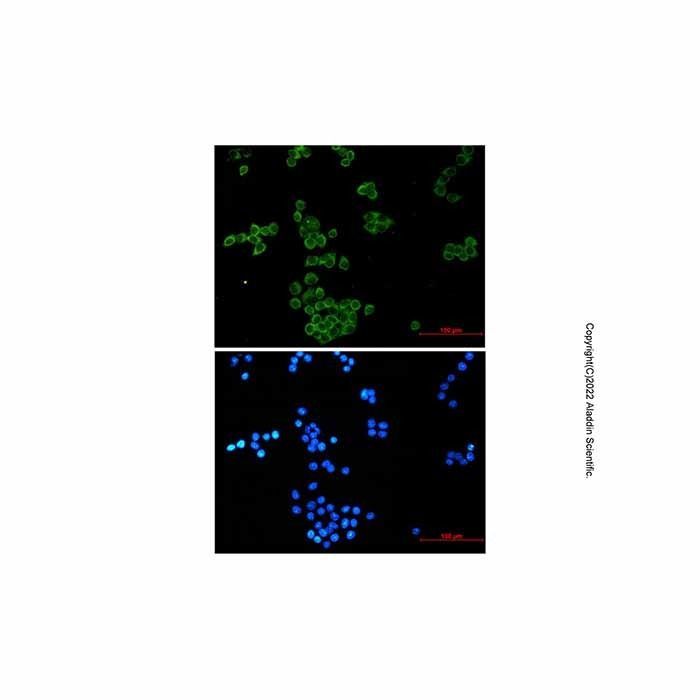 Recombinant Nck Antibody -    by Aladdin Scientific