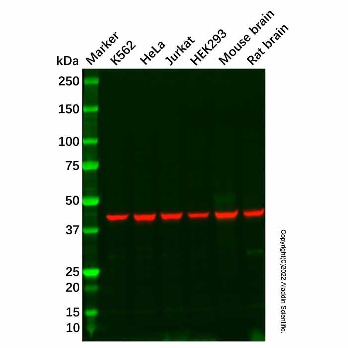 NDRG1 Antibody -    by Aladdin Scientific