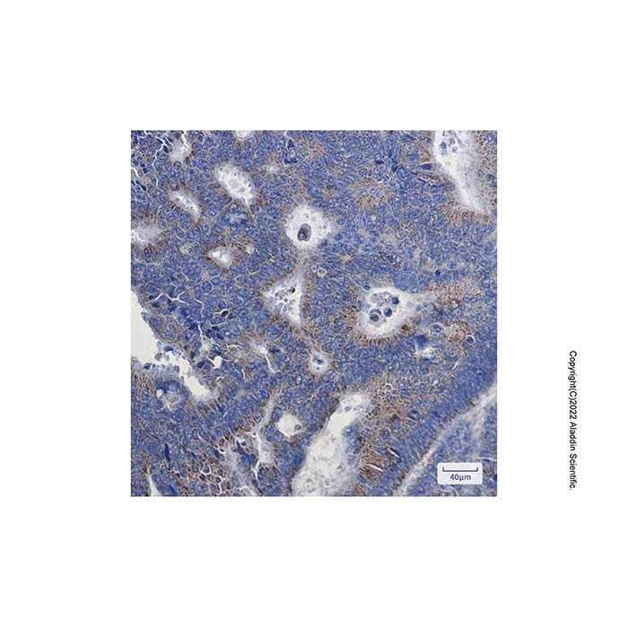 Recombinant NDUFA1 Antibody -    by Aladdin Scientific