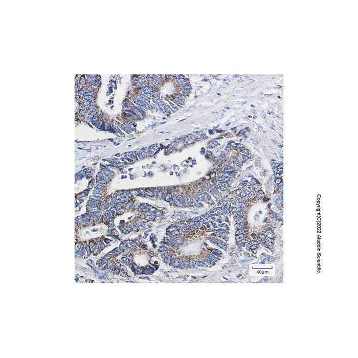 Recombinant NDUFB10 Antibody -    by Aladdin Scientific